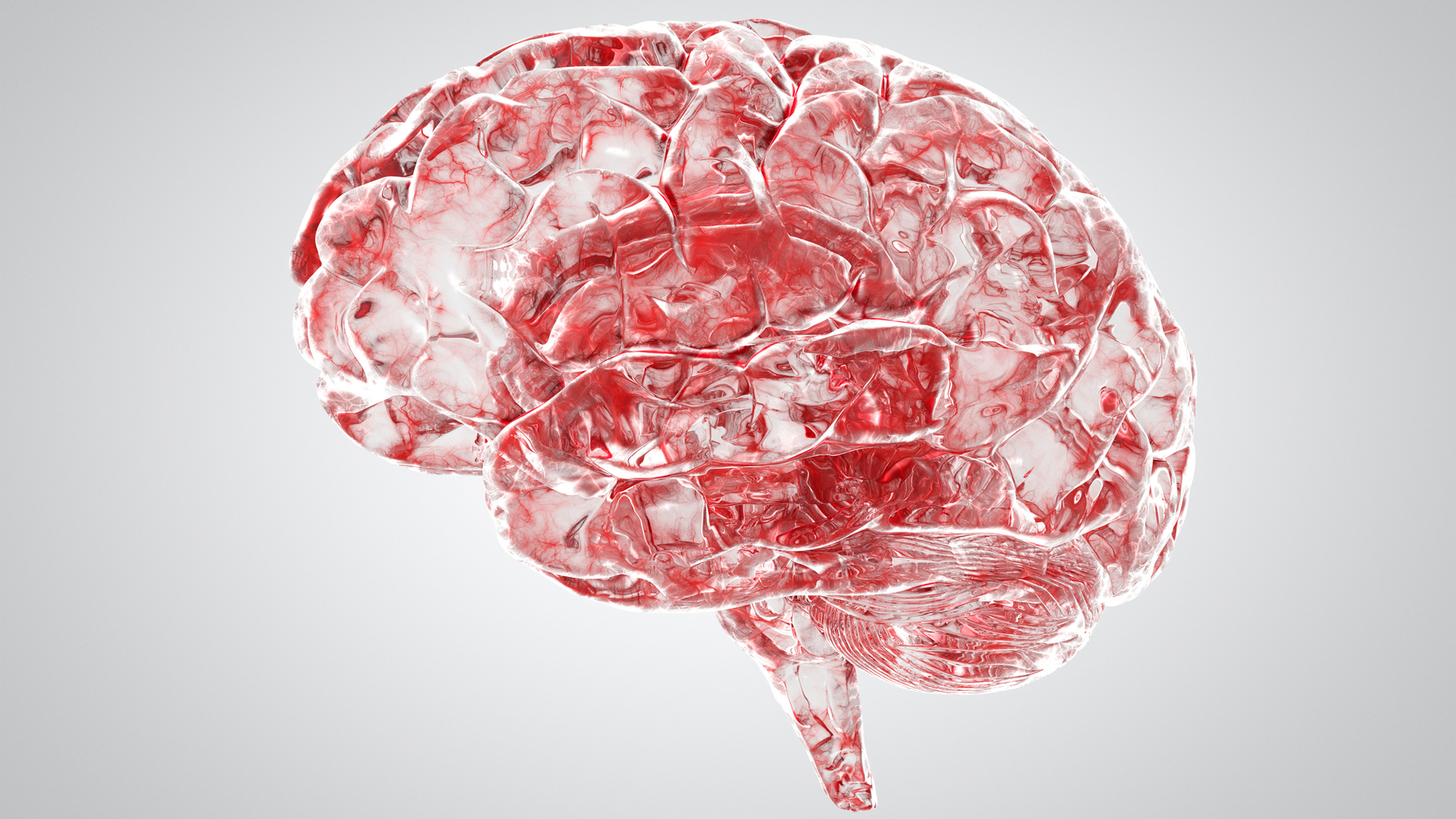 subarachnoid haemorrhage