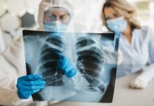 Tackling nasogastric tube misplacement nasogastric tube misplacement