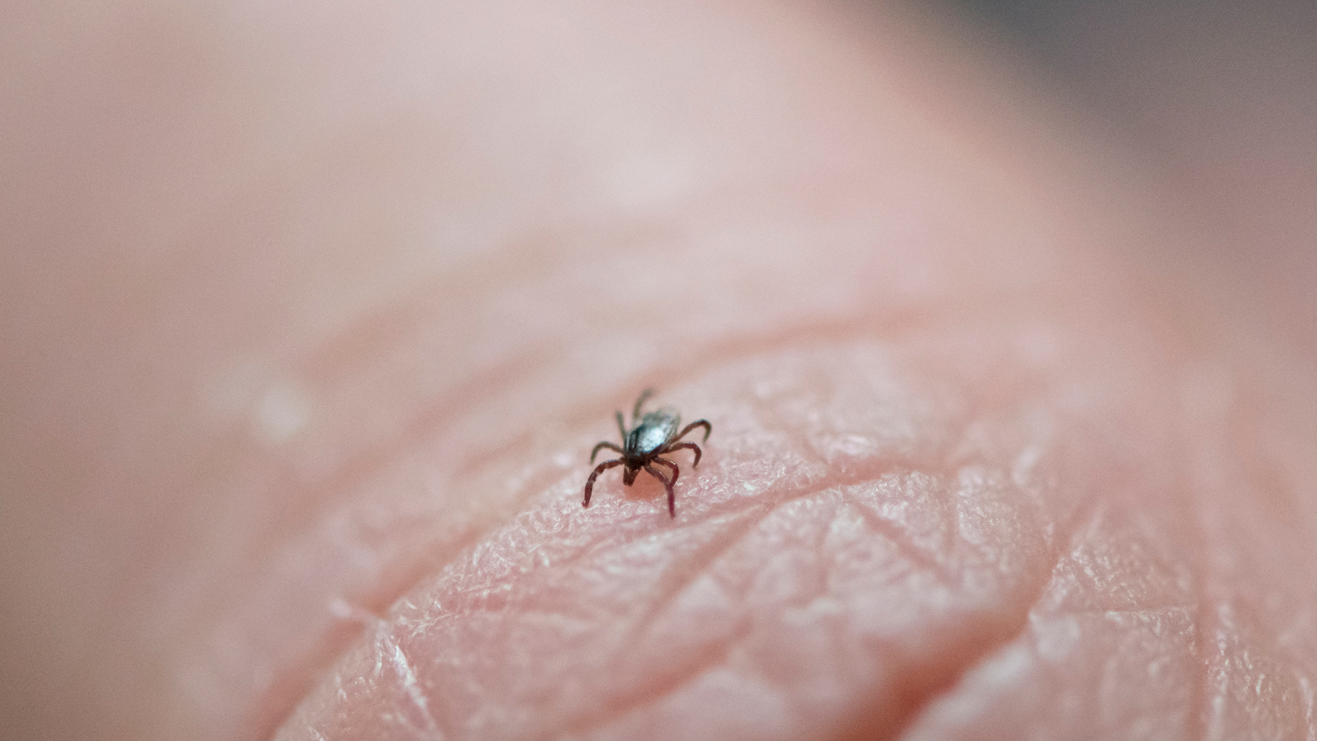 New study shows Lyme disease alters immune system