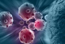 Potential treatment kills lymphoma whilst leaving healthy cells alone