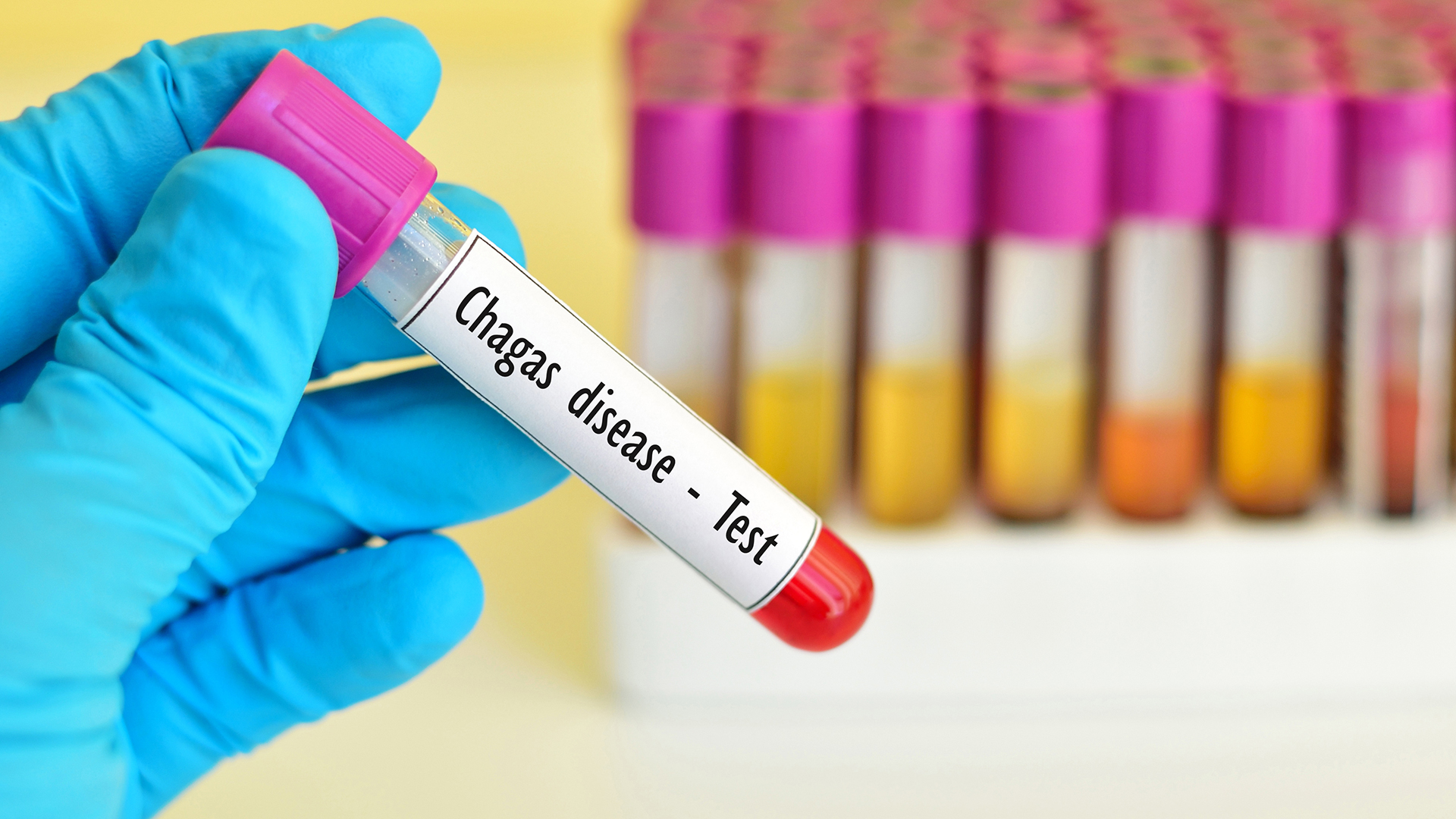 Renewed collaboration to eliminate tropical diseases