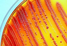 A faster way to test bacteria for antibiotic resistance A faster way to test bacteria for antibiotic resistance