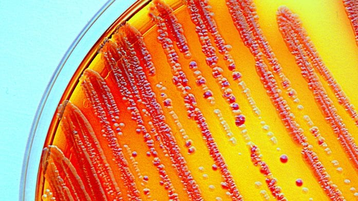 © iStock-Scharvik A faster way to test bacteria for antibiotic resistance
