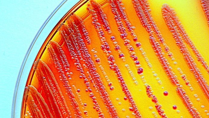 A faster way to test bacteria for antibiotic resistance