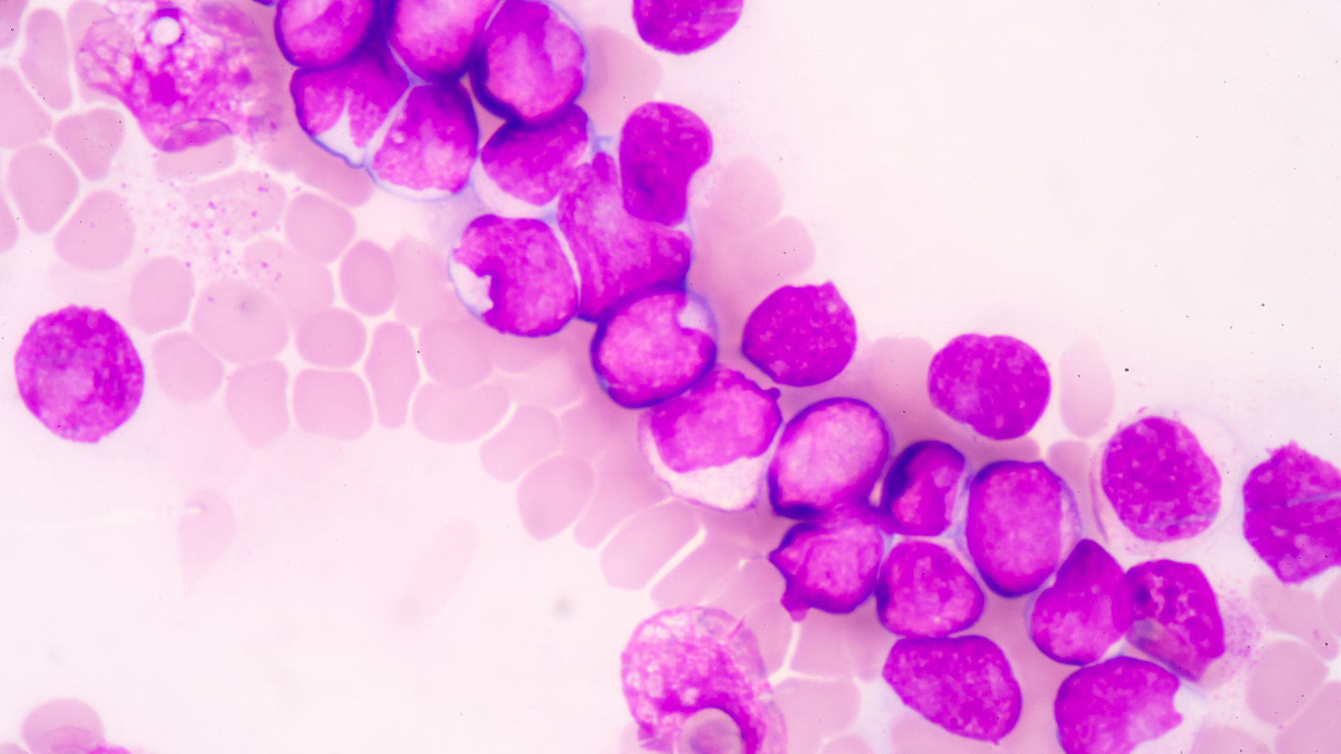 Chemotherapy-free treatment for Chronic Lymphocytic Leukaemia patients