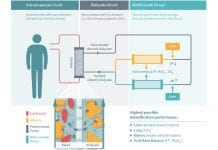 ADVOS multi-organ support to tackle multi-organ failure ADVOS multi-organ support to tackle multi-organ failure