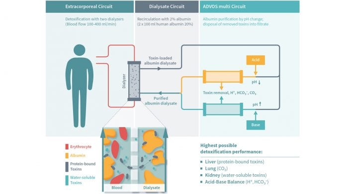 ADVOS multi-organ support to tackle multi-organ failure