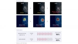 What are the benefits of AI in radiology and how can it be implemented?