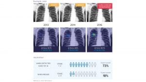 What are the benefits of AI in radiology and how can it be implemented?