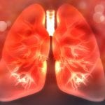 Exploring innovation in lung health during COVID-19