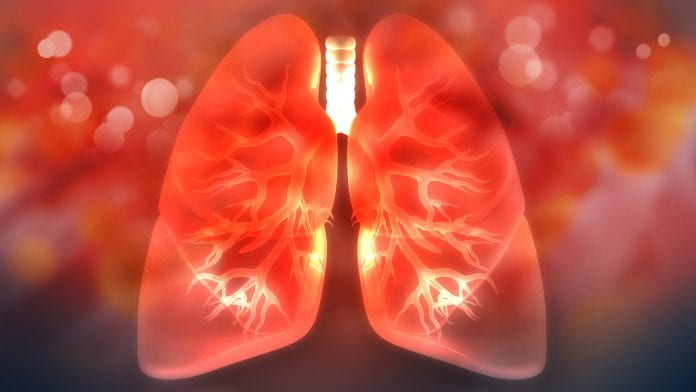 Exploring innovation in lung health during COVID-19