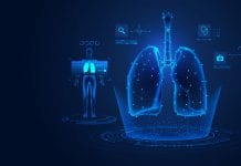 Choosing better lung cancer treatments with machine learning