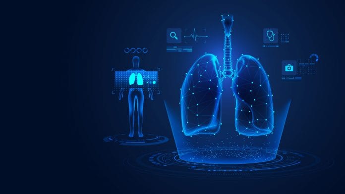 © iStock-Jackie Niam Choosing better lung cancer treatments with machine learning