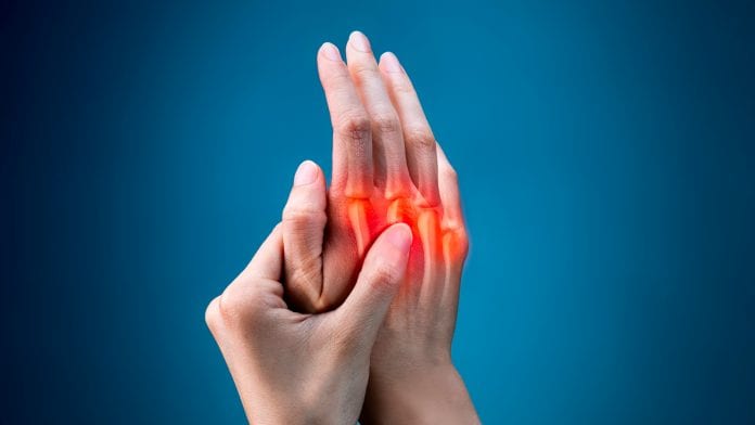Research collaboration to seek rheumatoid arthritis treatments