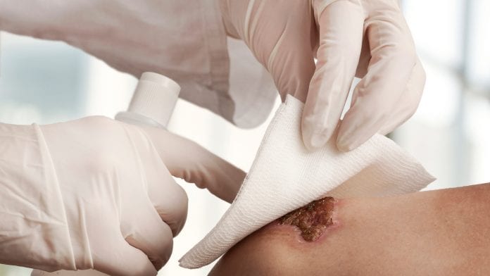 Hydrogel more beneficial for wound management than traditional methods