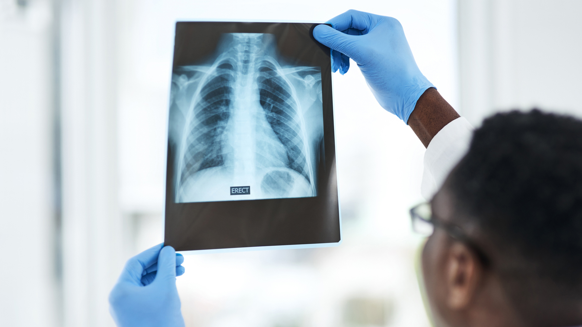 WHO says COVID-19 highlights urgent need for global effort to end TB