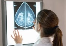 UK early breast cancer care still effective during COVID-19 UK early breast cancer care still effective during COVID-19
