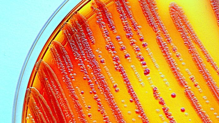 Global failure to tackle urgent threat of antibiotic resistance
