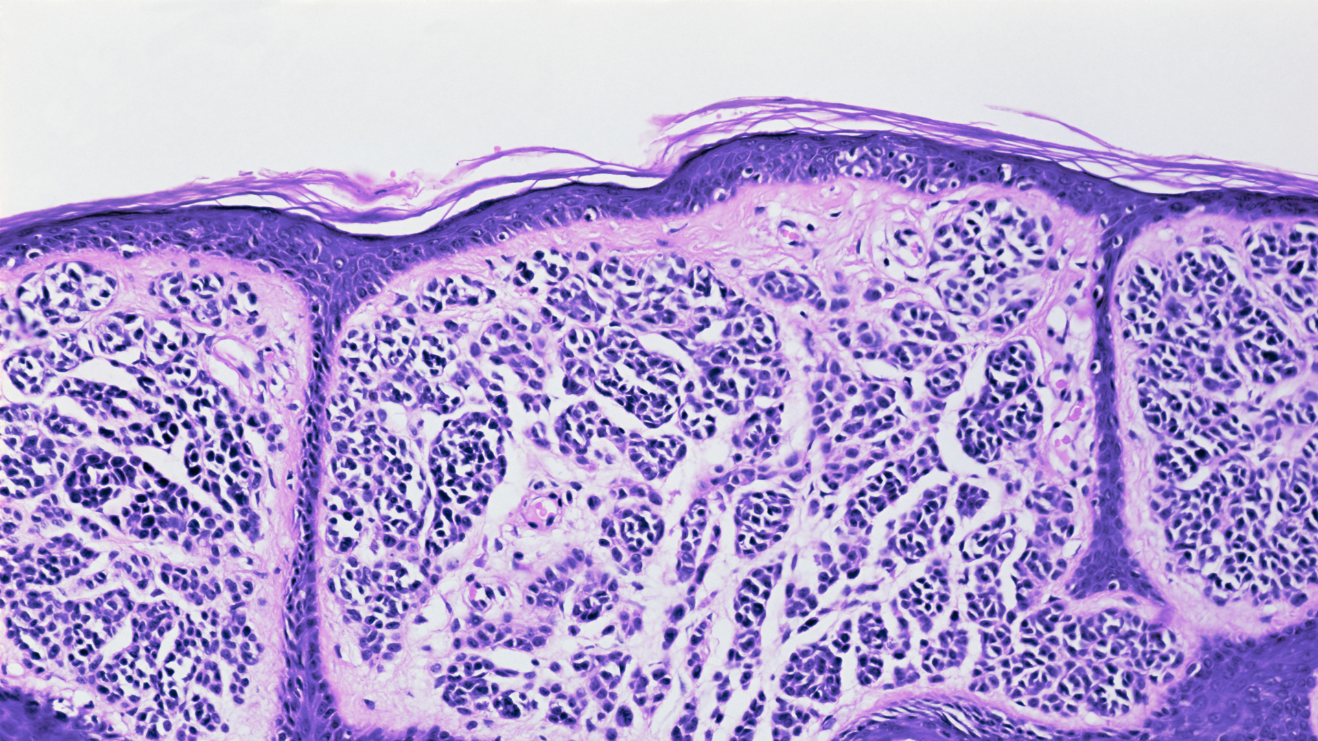 Organ regeneration one step closer with new understanding of skin repair