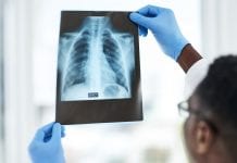 Researchers discover potential new way of fighting TB