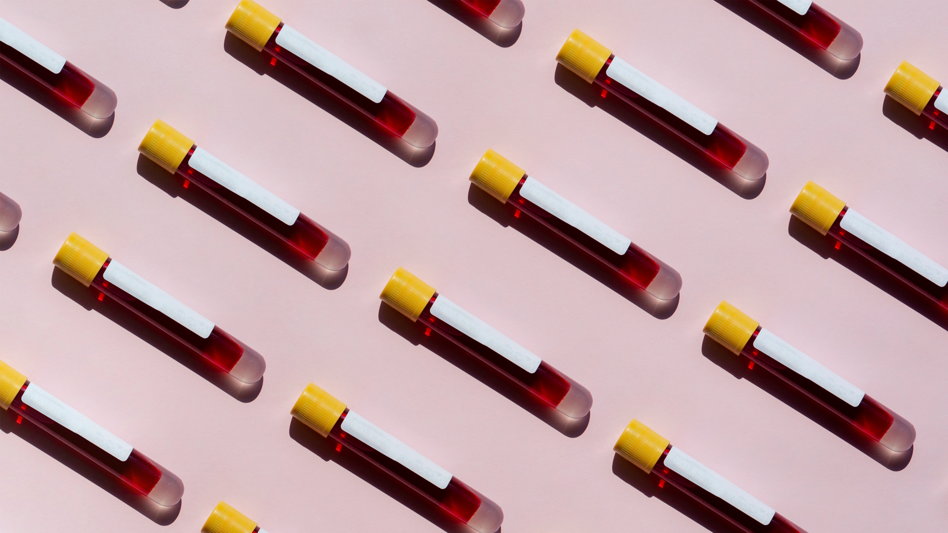 Mental disorder diagnosis breakthrough could offer personalised treatment