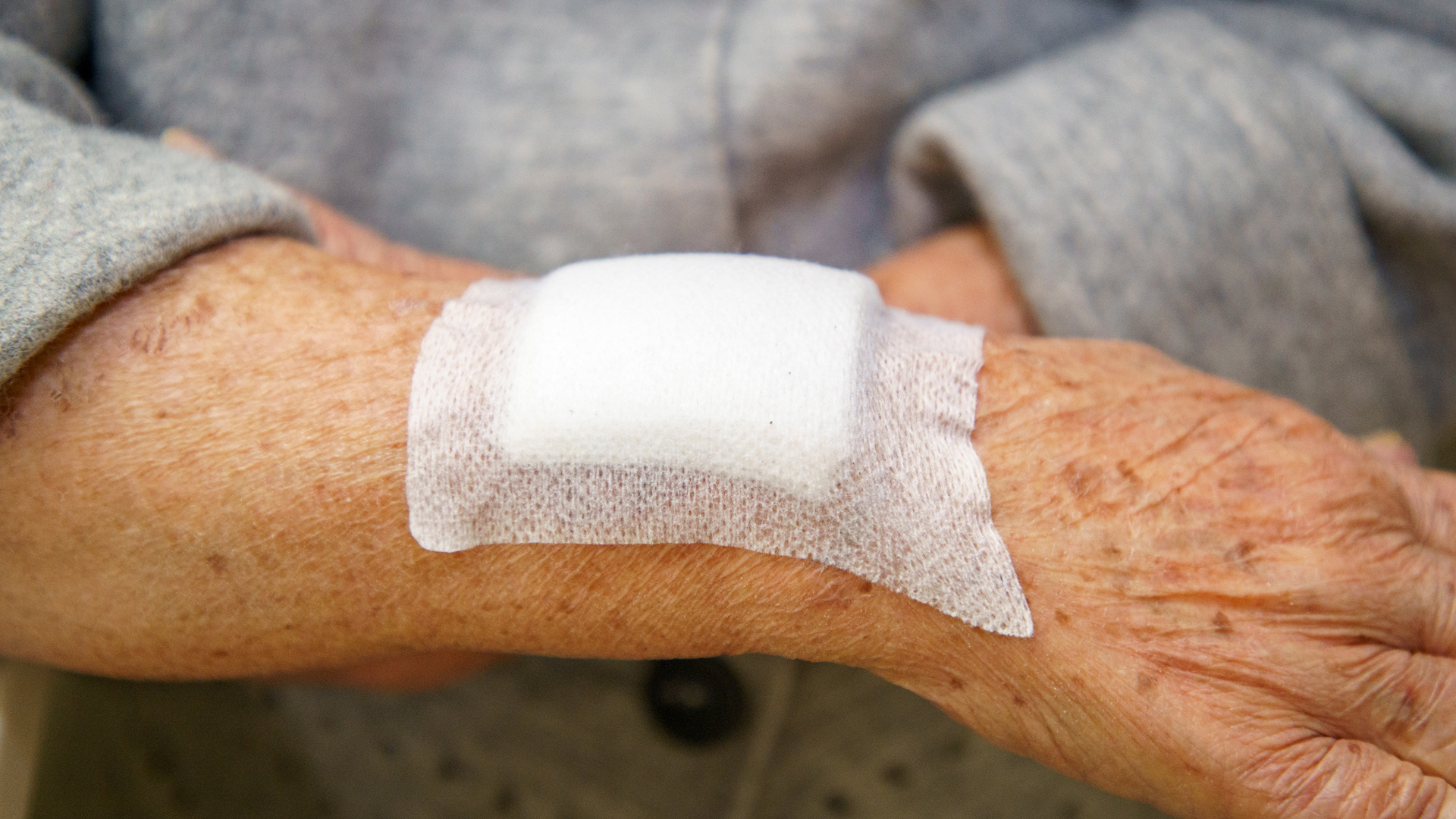 Clinical wound care and infection control