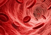 Recurring upper body blood clots caused by COVID-19 blood clots