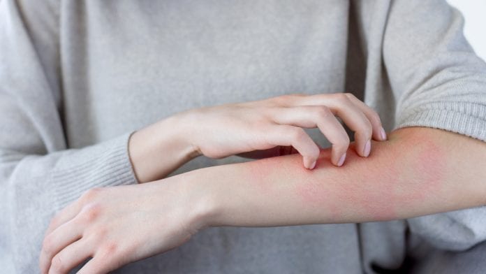 Discovery could change skin inflammation and dermatologic treatment