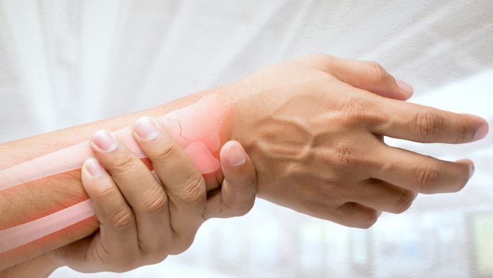 © iStock/Tharakorn Bone health, osteoporosis, and innovation