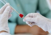 Rapid testing and COVID-19 tracking in Europe Rapid testing and COVID-19 tracking in Europe