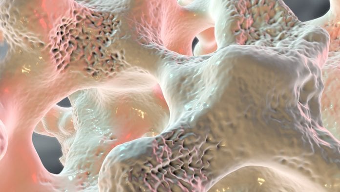 © iStock/Dr_Microbe Exploring osteoporosis and bone health