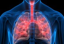 Post-COVID syndrome: after the pandemic, the pulmonary consequences Post-COVID syndrome: after the pandemic, the pulmonary consequences