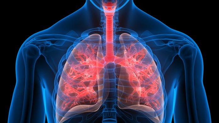 © iStock/magicmine Post-COVID syndrome: after the pandemic, the pulmonary consequences