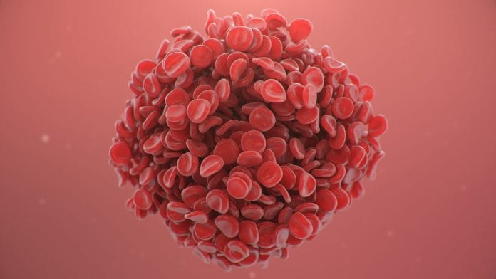 AstraZeneca/Oxford vaccine blood clots mitigated with early detection