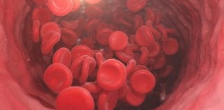 Revolutionising blood management for cancer surgery