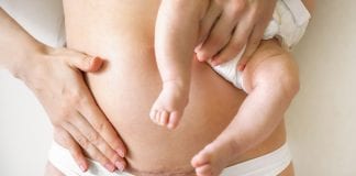 Study shows beneficial bacteria can be restored to C-section babies