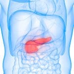 artificial-intelligence-pancreatic-cancer