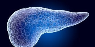 New biomarker identified to diagnose pancreatic cancer