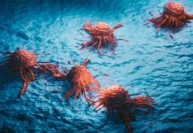 Optimising metastatic melanoma therapy by combining two treatments metastatic melanoma