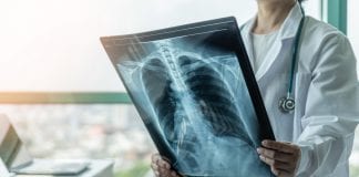 Reducing tuberculosis in England with a long-term action plan