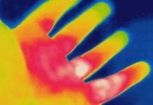 thermal-imaging-wound-care