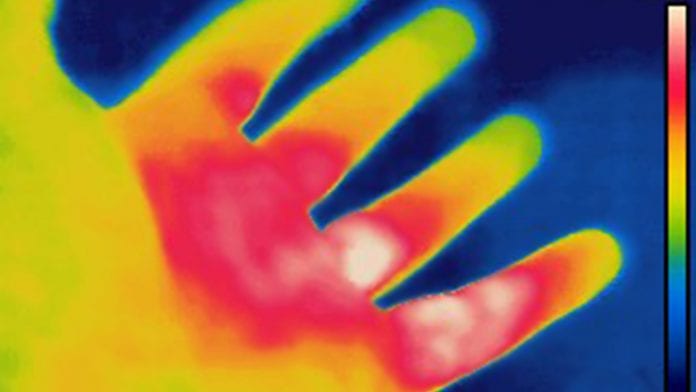thermal-imaging-wound-care