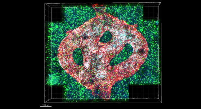 3D-bioprinting