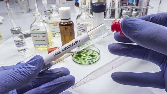 Expert analyzes stuffed meat contaminated by bacterium of listeria in laboratory, sprout caused in Spain Nova Biologicals: Meeting food safety standards to prevent infection