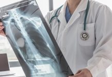 New marker for bone cancer prognosis could lead to life-saving treatments bone-cancer