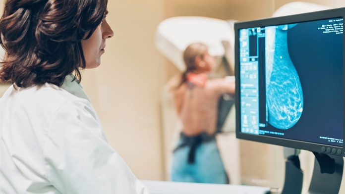 © iStock-pixelfit breast cancer