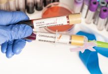 Omicron named a SARS-CoV-2 variant of concern by WHO Omicron named a SARS-CoV-2 variant of concern by WHO