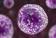 €1m grant awarded to enhance research for lymphoma treatment lymphoma tretament