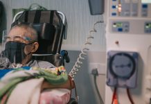 Investigating the impacts of COVID-19 variants on dialysis treatment dialysis treatment