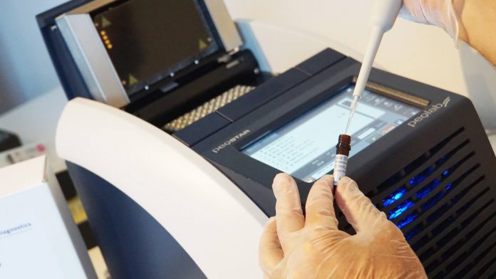 XPhyto Therapeutics: rapid PCR test for COVID-19 in development